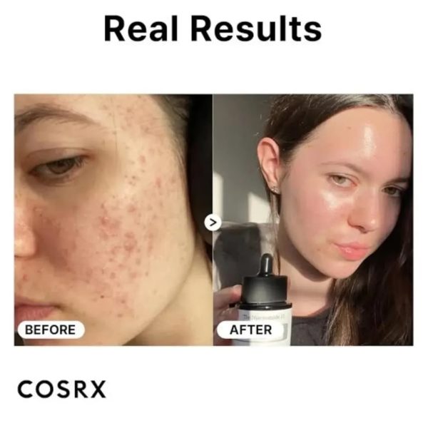 COSRX The Hyaluronic Acid 3 Serum - 20ml